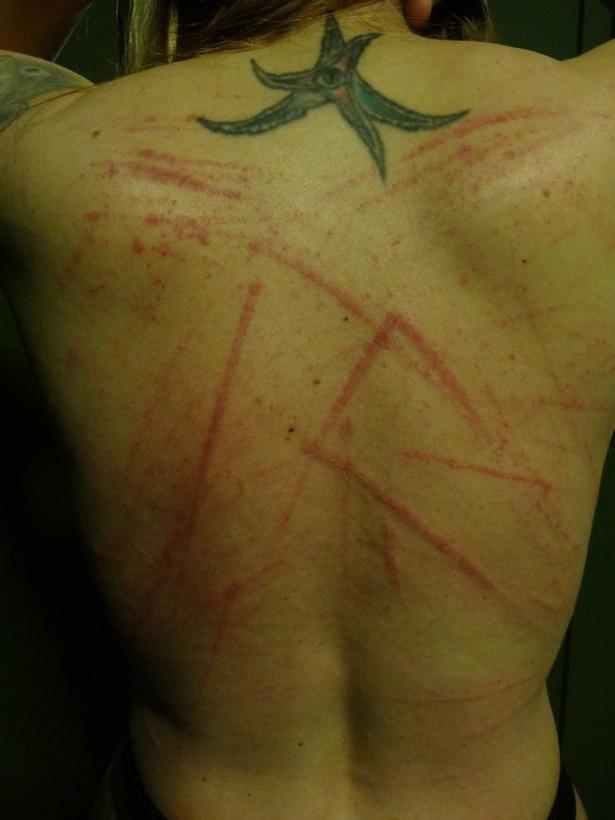 24P Whipped backs of girls
