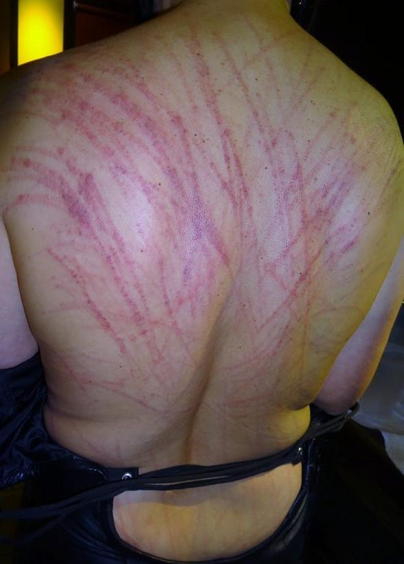 24P Whipped backs of girls