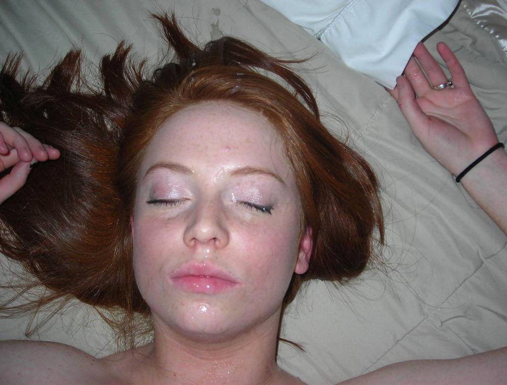 8P Freckles facial