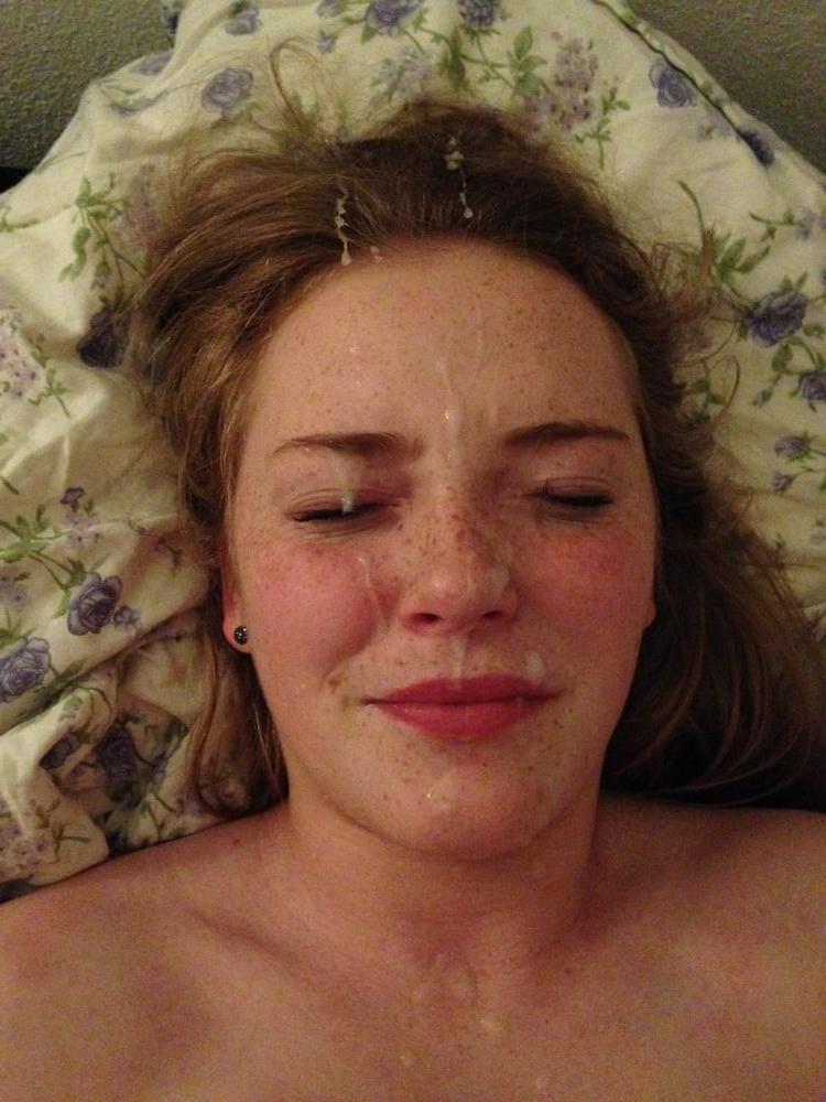 8P Freckles facial