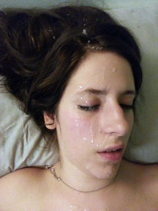 25P Facial 65