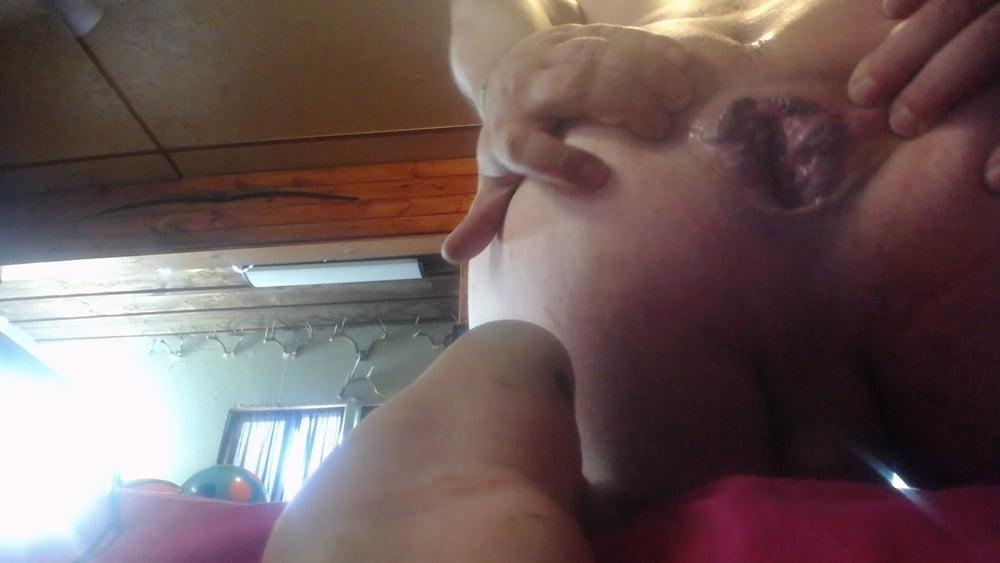 25P gape