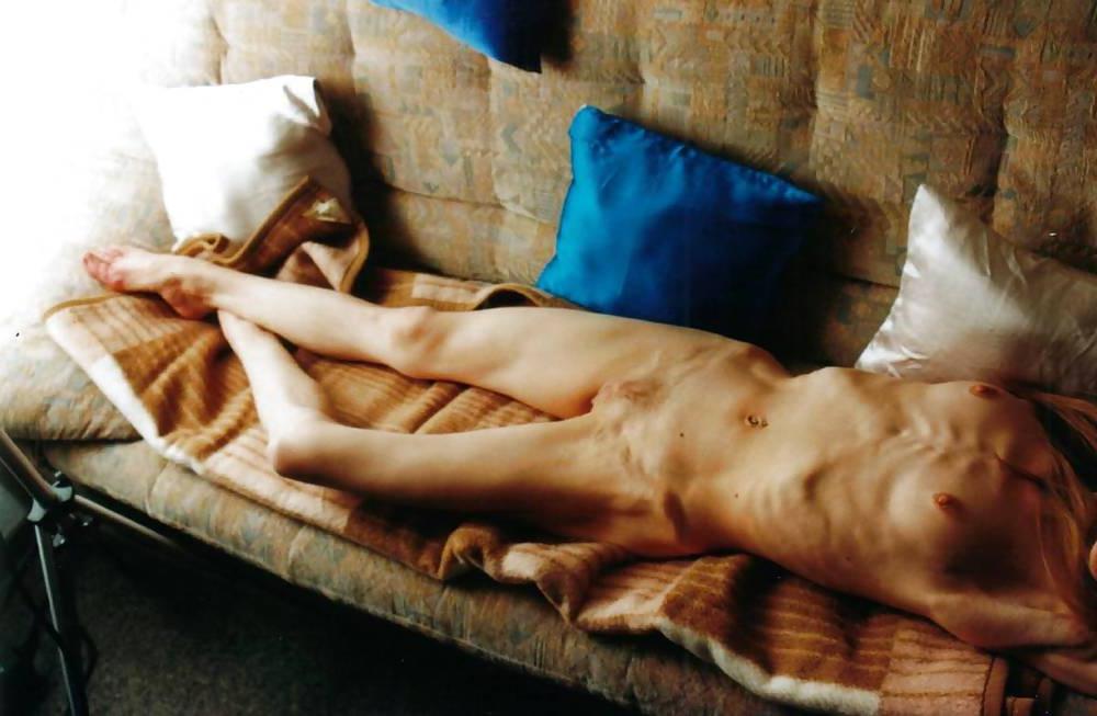25P Pretty Anorexic Girl