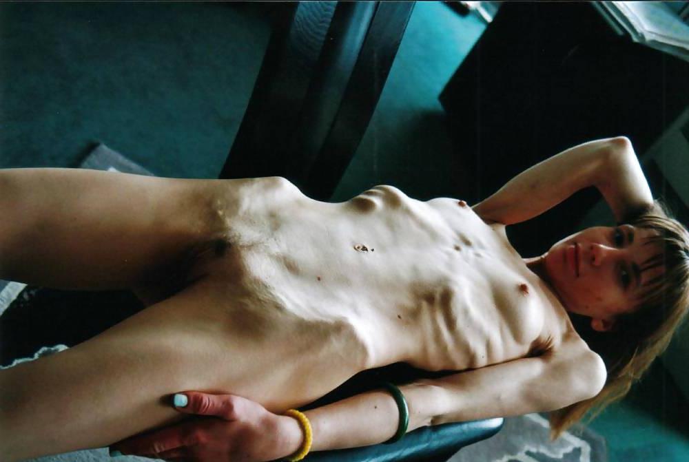 25P Pretty Anorexic Girl