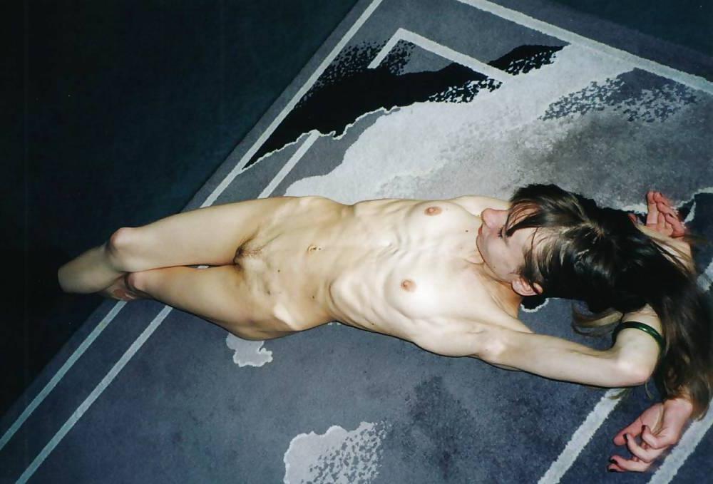 25P Pretty Anorexic Girl
