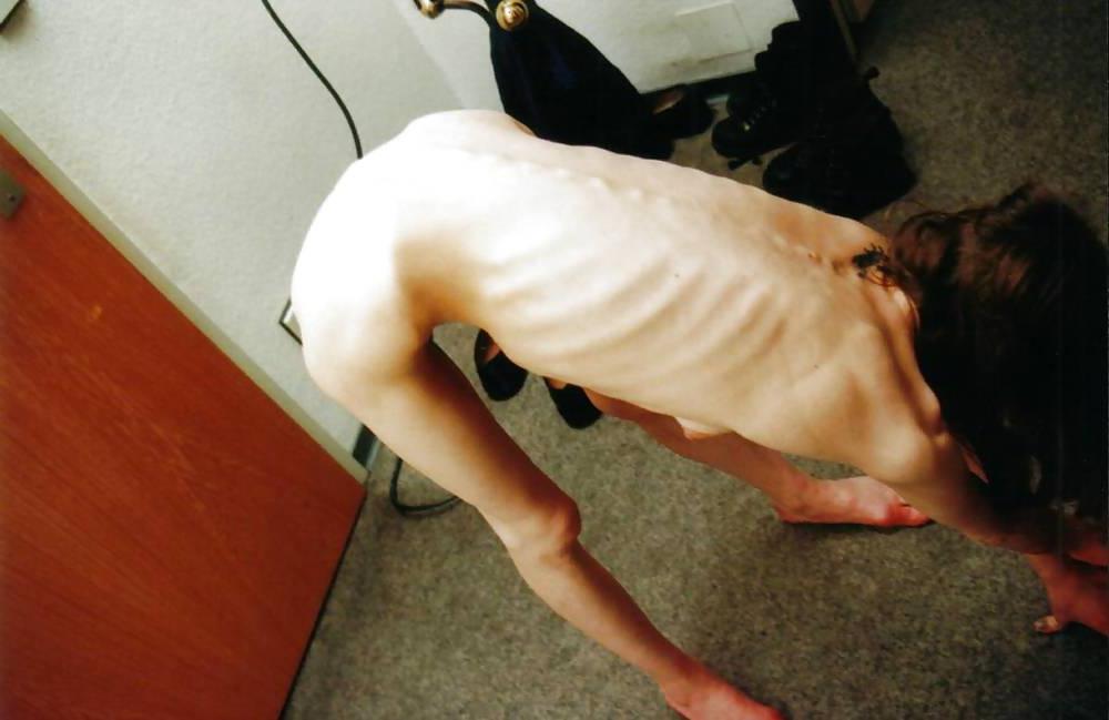 25P Pretty Anorexic Girl