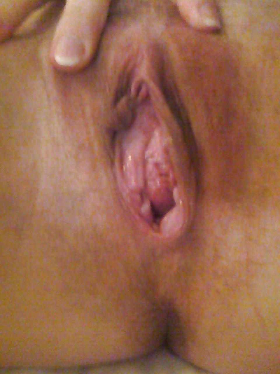 21P My EX Girlfriend self pussy pics.  Close up!