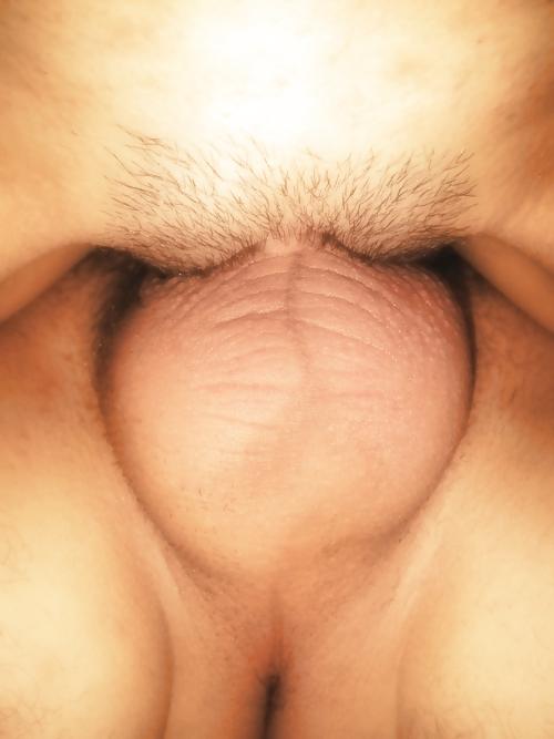 25P Prostatamassage