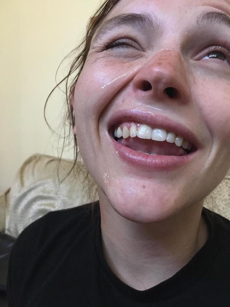25P Facial