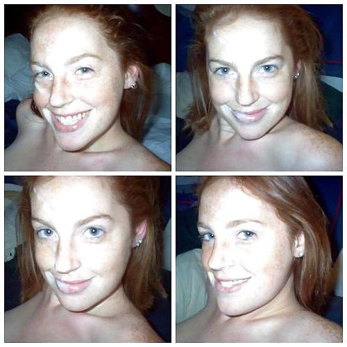 25P HOT FACIALS