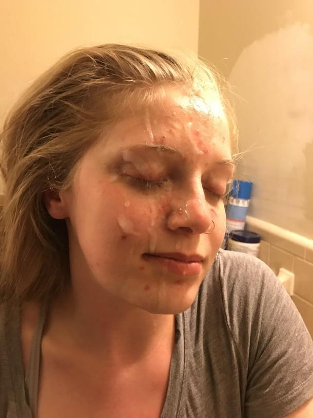 24P Facial