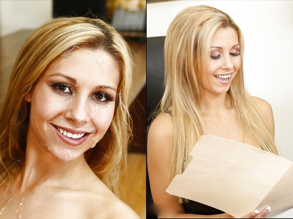 25P Before and After Facials