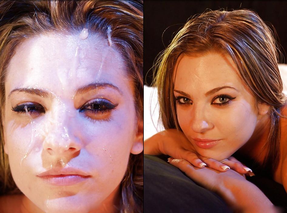 25P Before and After Facials