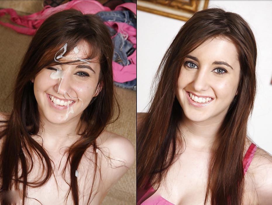 25P Before and After Facials