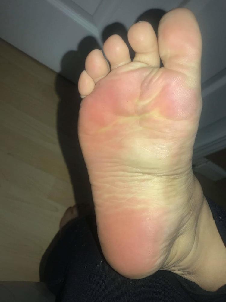 25P 25 year old BBW mexican Soles Nut draining wrinkles