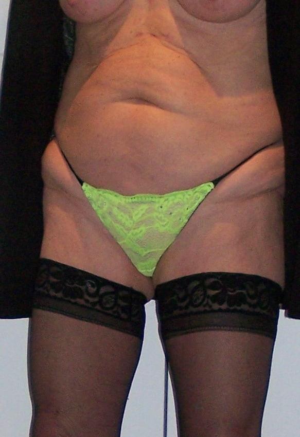 24P Neon Bra and Thong #2
