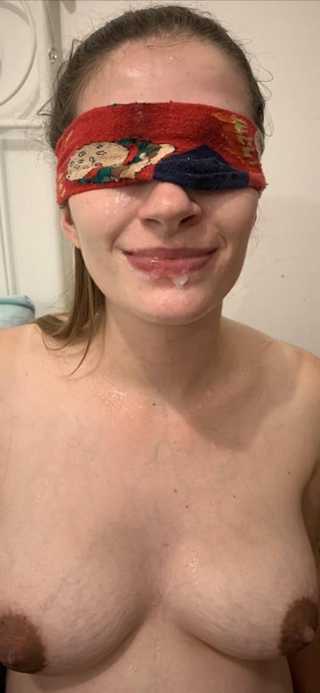 9P facial