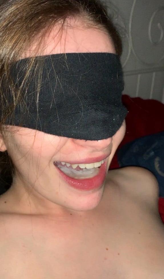 9P facial