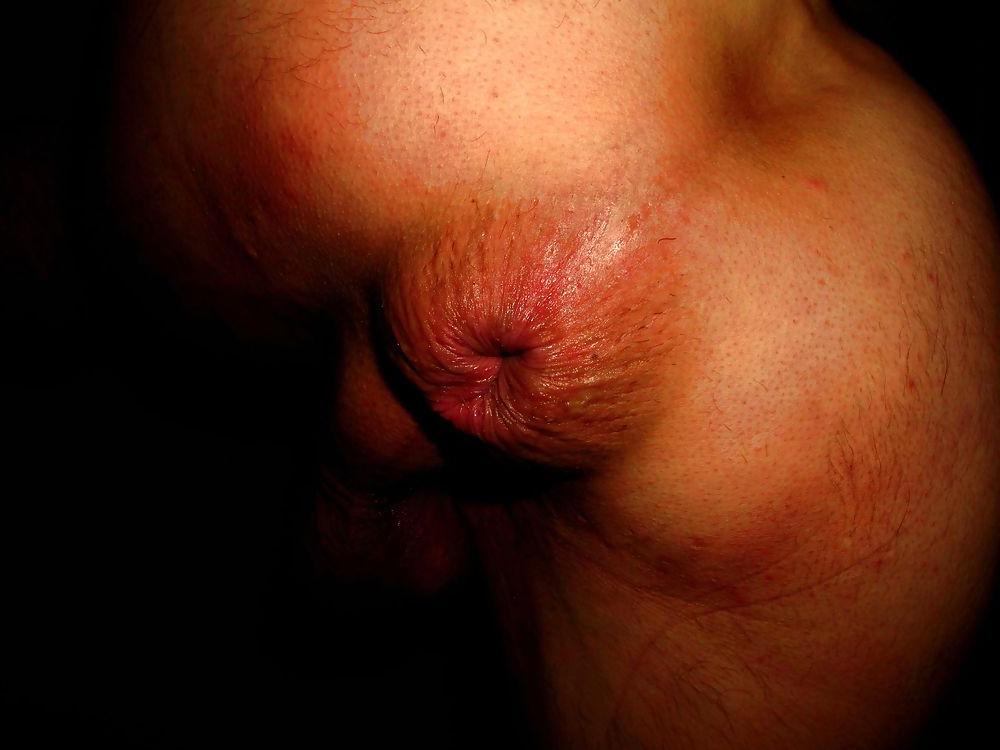 25P Extreme prolapse gape asshole by Marques