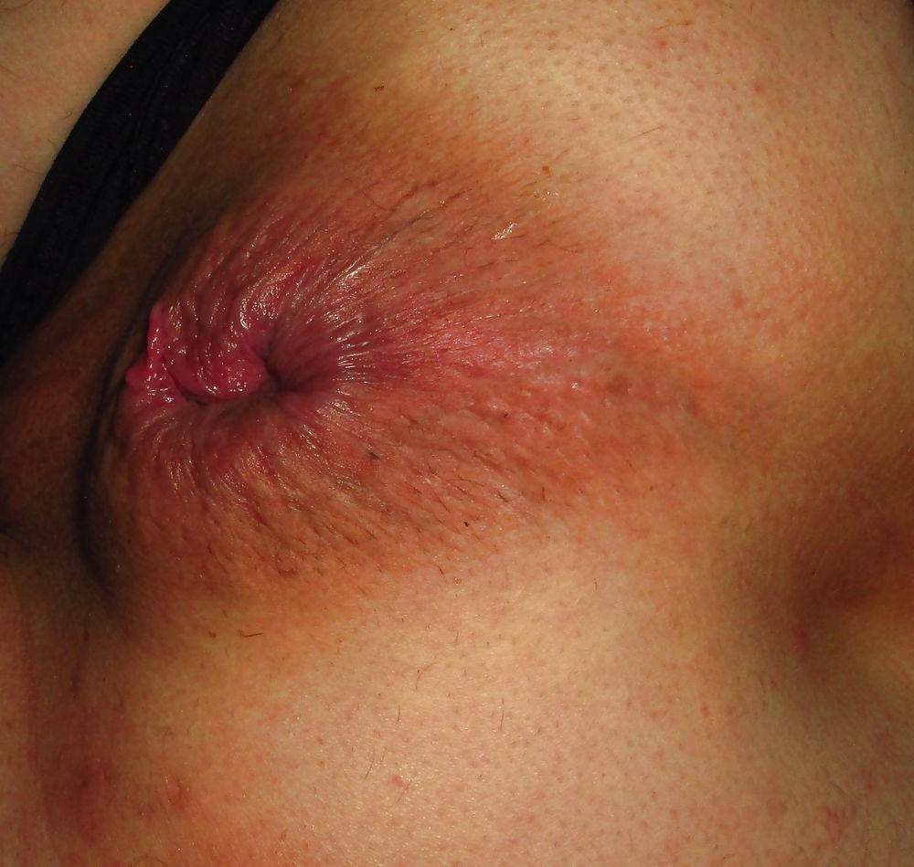 25P Extreme prolapse gape asshole by Marques