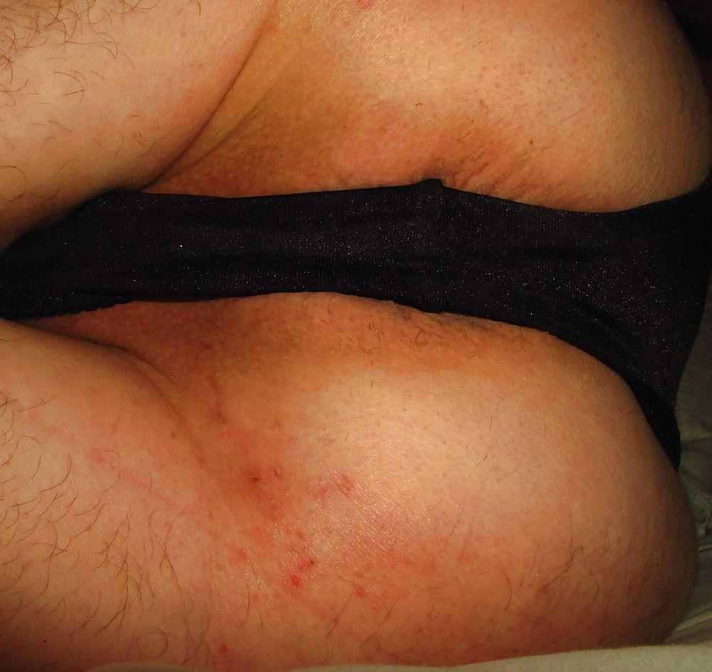 25P Extreme prolapse gape asshole by Marques
