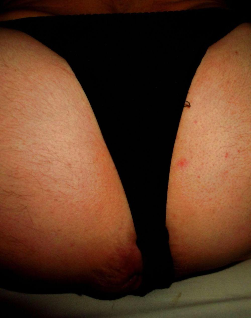 25P Extreme prolapse gape asshole by Marques