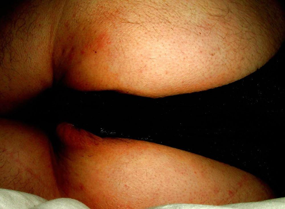 25P Extreme prolapse gape asshole by Marques