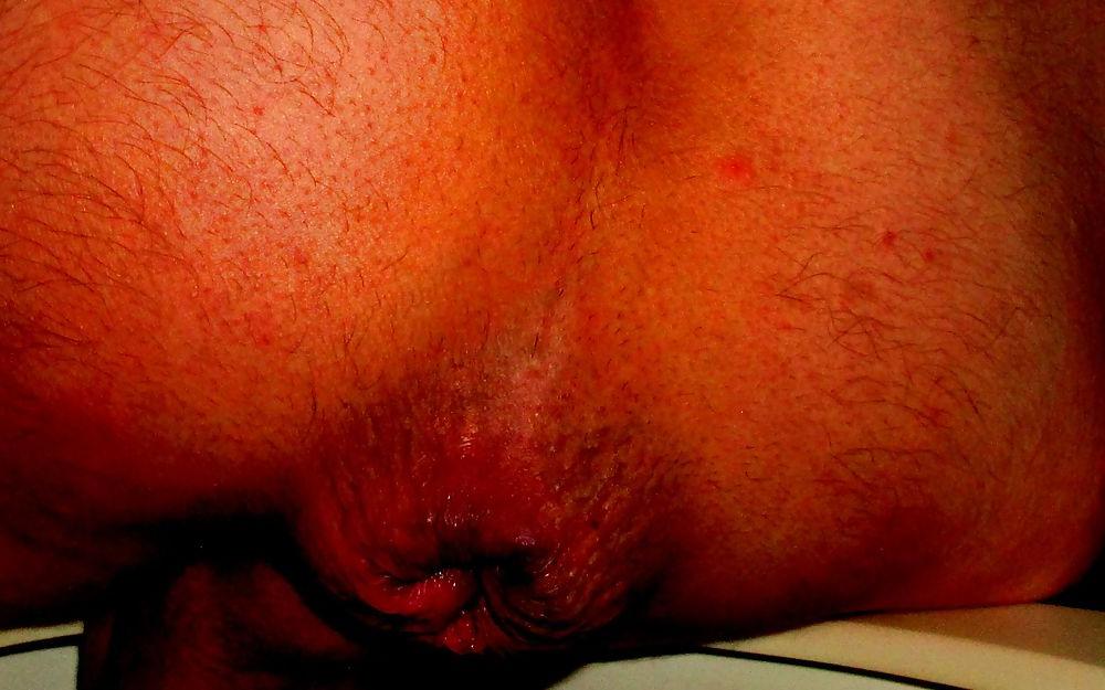 25P Extreme prolapse gape asshole by Marques