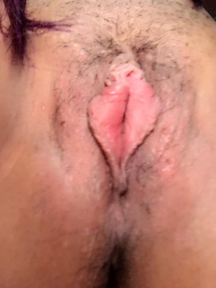 13P Chinese Amateur-175