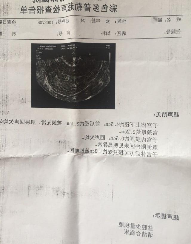 25P Chinese Amateur-119