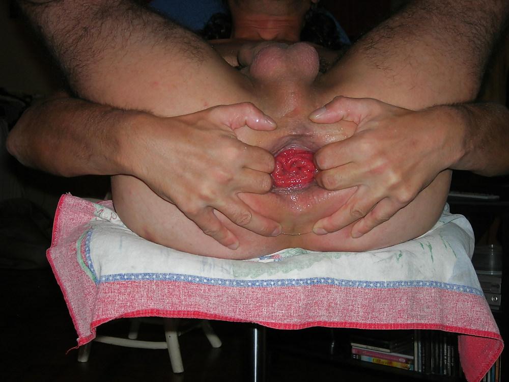 12P Anus bien dilate