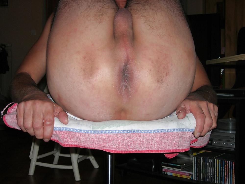 12P Anus bien dilate