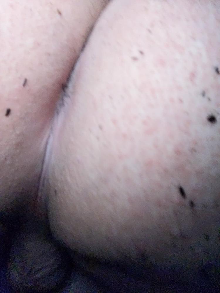 25P Outdoor Pictures #1 late night jerking