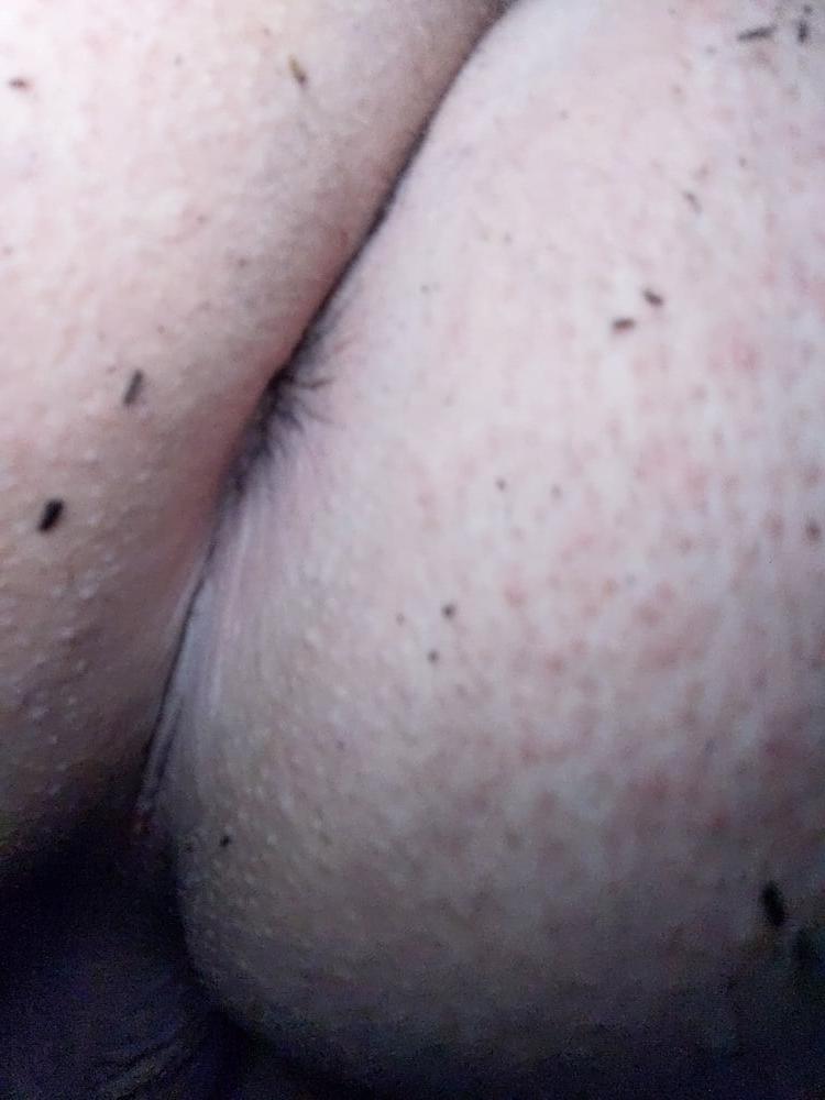 25P Outdoor Pictures #1 late night jerking