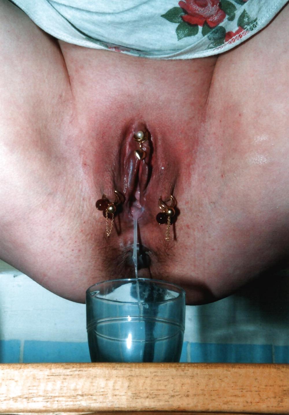 15P ANUS SAILLANT