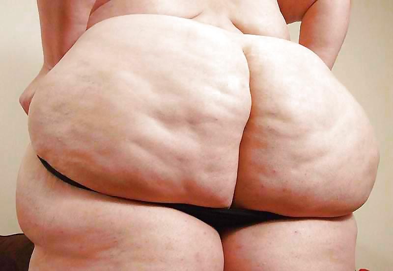 25P Thick, White, and Cellulite 13