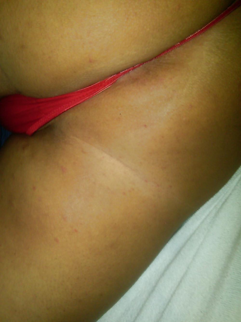 20P RED Thong