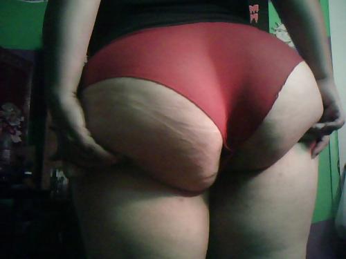 20P Thick, White, and Cellulite 5