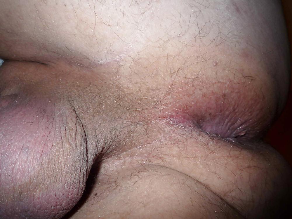 10P Penis und Anus