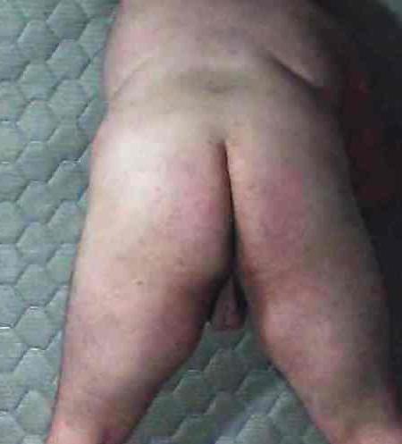 20P Fat nude sissy
