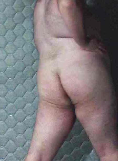 20P Fat nude sissy