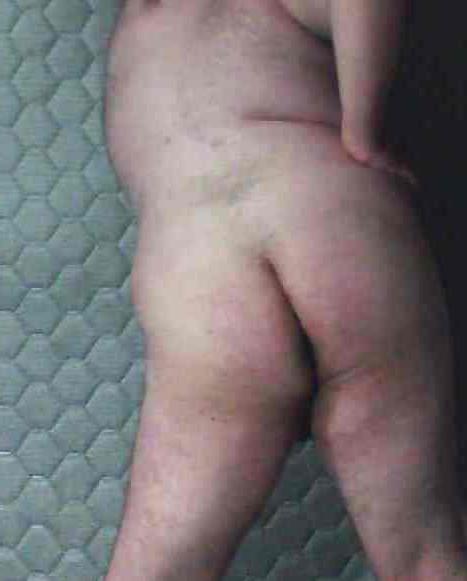 20P Fat nude sissy