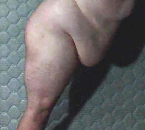 20P Fat nude sissy