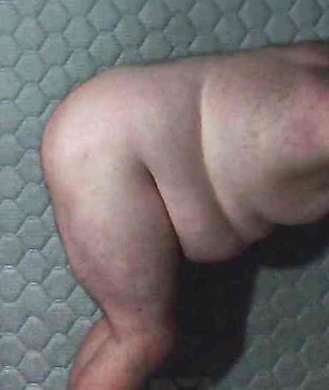 20P Fat nude sissy