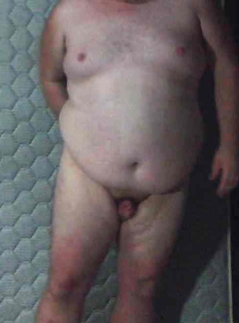 20P Fat nude sissy