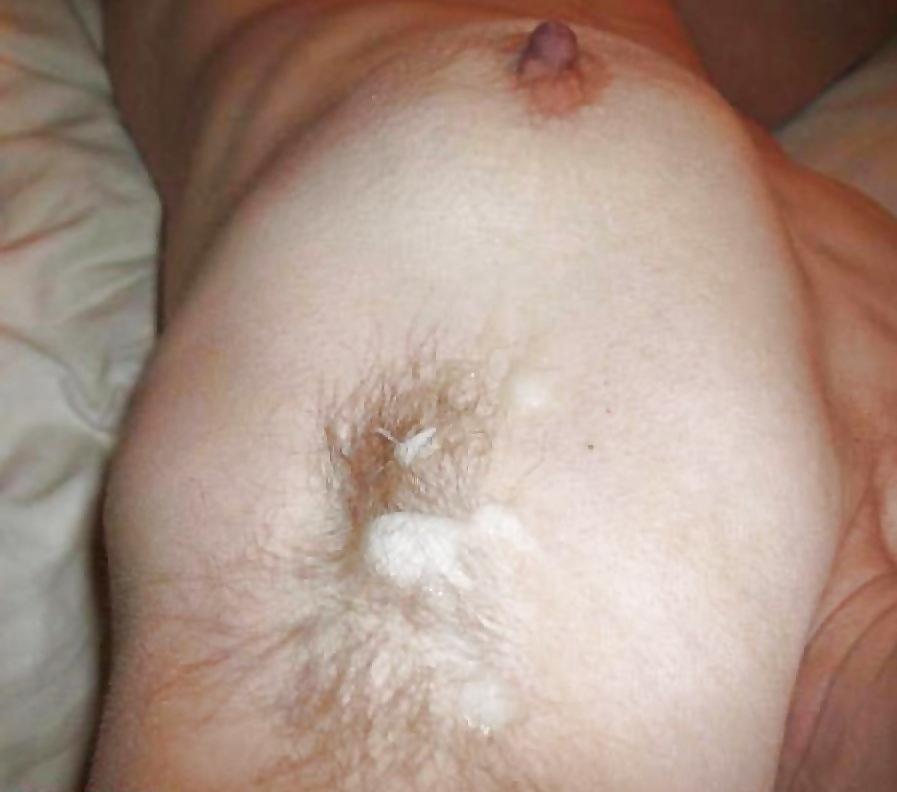 23P Armpit