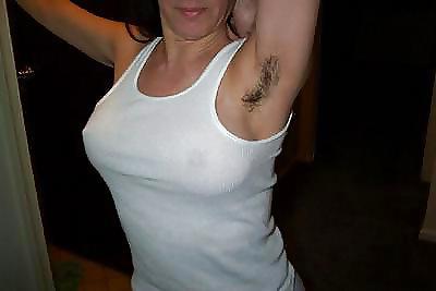 23P Armpit