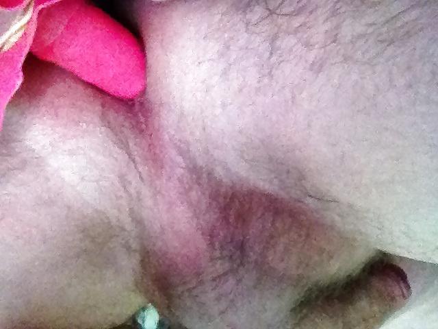 8P Anus for use
