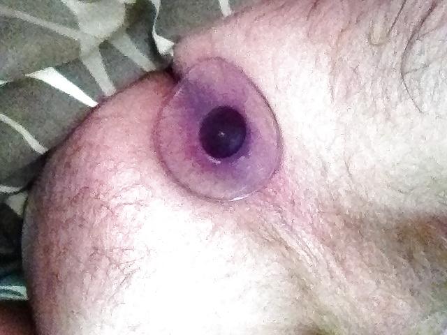 8P Anus for use