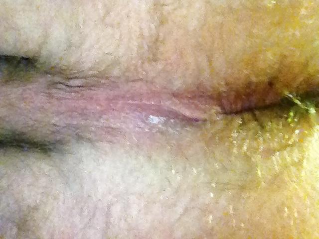 8P Anus for use